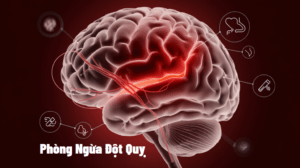 phòng ngừa đột quỵ