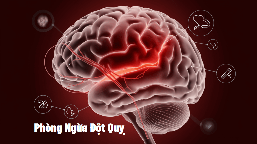 phòng ngừa đột quỵ