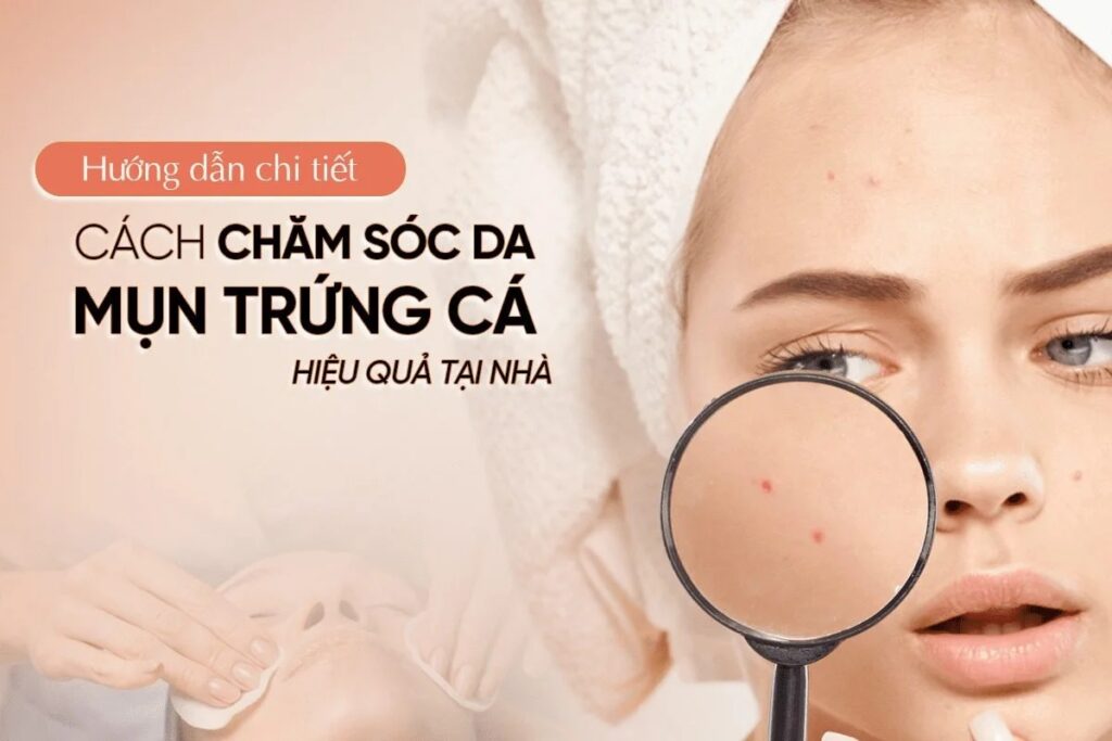 Chăm sóc da mụn hiệu quả